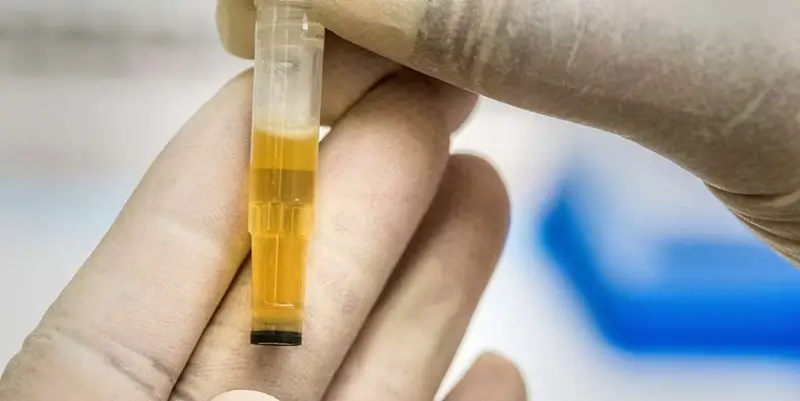 werner drug testx